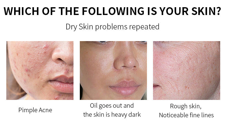 AHA 30% + BHA 2% Peeling Solution | Exfoliating Face Serum for Brighter, Smoother Skin