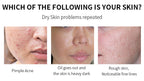AHA 30% + BHA 2% Peeling Solution | Exfoliating Face Serum for Brighter, Smoother Skin