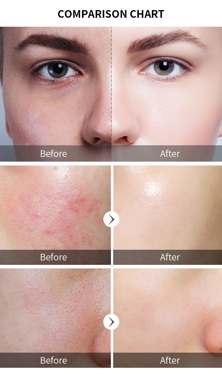 AHA 30% + BHA 2% Peeling Solution | Exfoliating Face Serum for Brighter, Smoother Skin