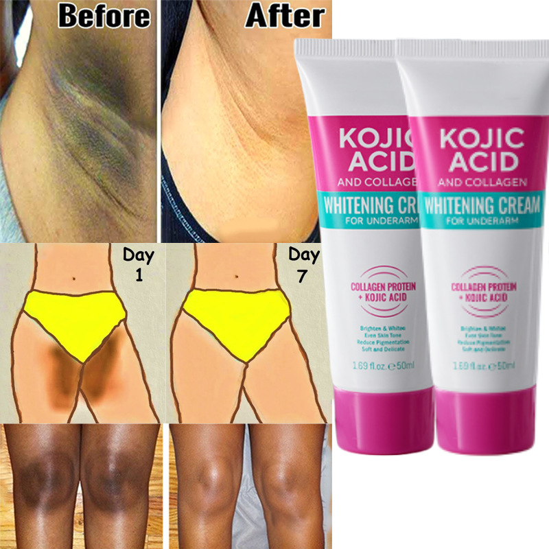 Kojic Acid Whitening Cream for Underarm Knees and Elbows with Collagen Dark Spot Remover Moisturize and Brighten the Skin