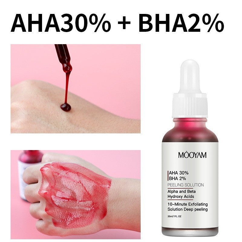AHA 30% + BHA 2% Peeling Solution | Exfoliating Face Serum for Brighter, Smoother Skin
