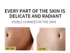 Vitamin E Skin Therapy Oil for Scars, Stretch Marks & Dry Skin - 125ml / 4.2 fl oz