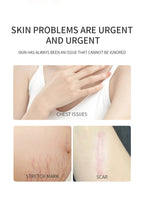 Vitamin E Skin Therapy Oil for Scars, Stretch Marks & Dry Skin - 125ml / 4.2 fl oz