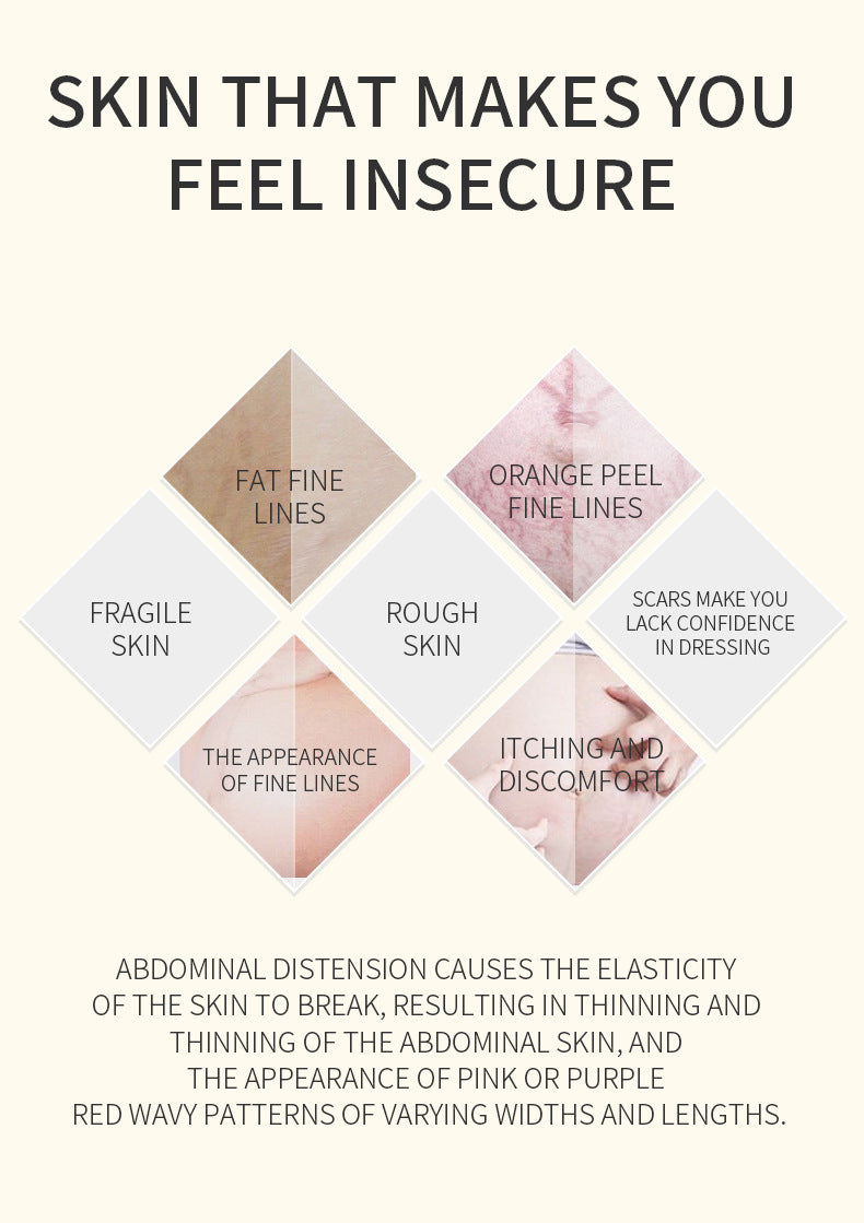 Vitamin E Skin Therapy Oil for Scars, Stretch Marks & Dry Skin - 125ml / 4.2 fl oz