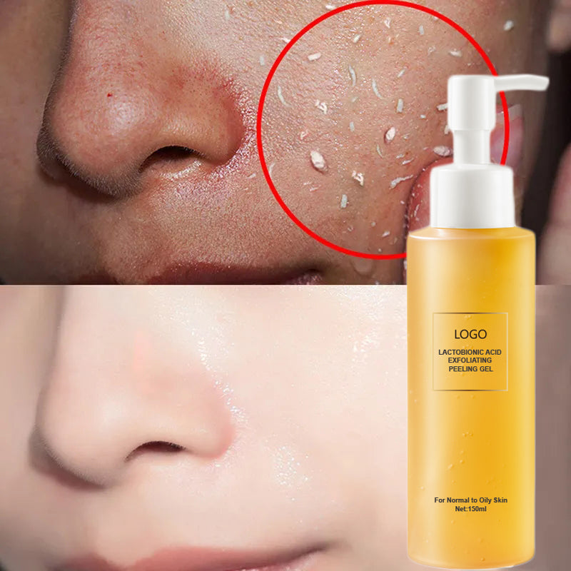 Lactobionic Acid Exfoliating Gel Cleanser | Pore Refining & Brightening Face Scrub