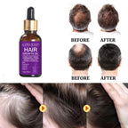 Alinna Beauty Hair Growth Oil with Organic Rosemary Castor for Dry, Damaged & Split End