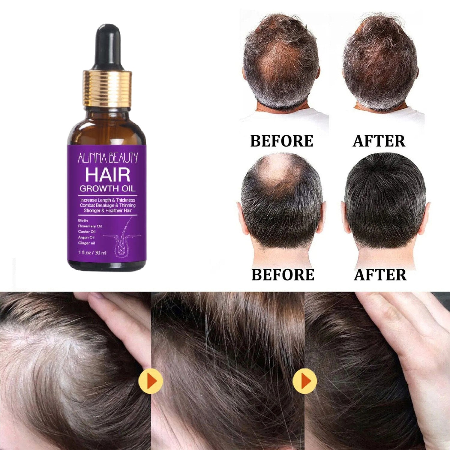 Alinna Beauty Hair Growth Oil with Organic Rosemary Castor for Dry, Damaged & Split End