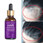 Alinna Beauty Hair Growth Oil with Organic Rosemary Castor for Dry, Damaged & Split End