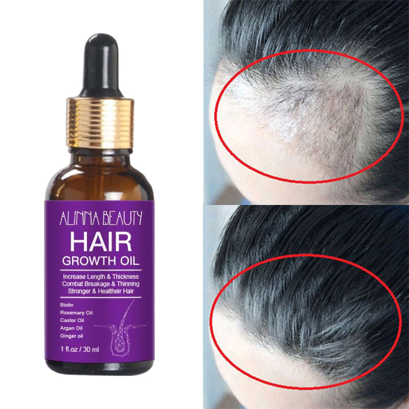 Alinna Beauty Hair Growth Oil with Organic Rosemary Castor for Dry, Damaged & Split End