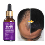 Alinna Beauty Hair Growth Oil with Organic Rosemary Castor for Dry, Damaged & Split End