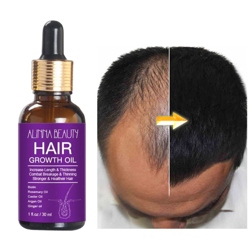 Alinna Beauty Hair Growth Oil with Organic Rosemary Castor for Dry, Damaged & Split End