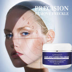 Alinna Beauty Dark Spot Correcting Cream with Kojic Acid, Niacinamide & Vitamin C for Uneven Tone