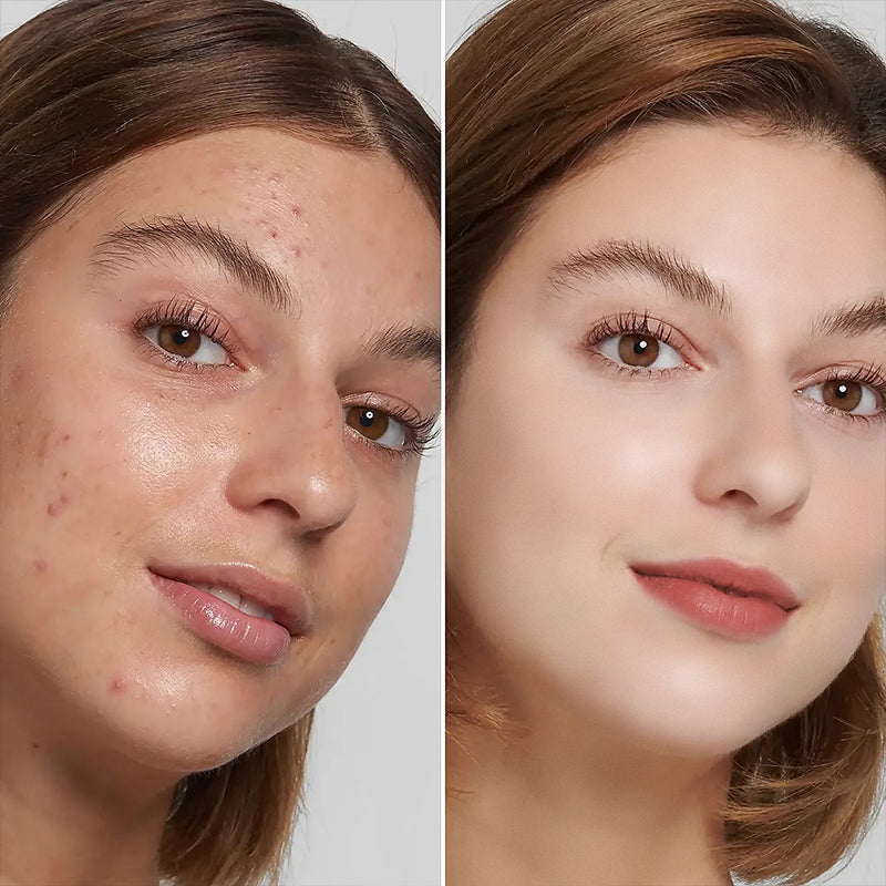 Alinna Beauty Dark Spot Correcting Cream with Kojic Acid, Niacinamide & Vitamin C for Uneven Tone