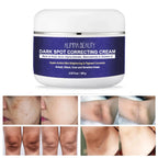 Alinna Beauty Dark Spot Correcting Cream with Kojic Acid, Niacinamide & Vitamin C for Uneven Tone